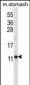 ATP5J Antibody (Center)